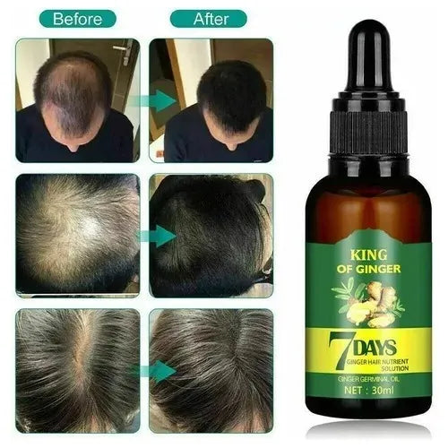 King of Ginger 7 Days – Suero Natural Anticaída y Crecimiento Capilar