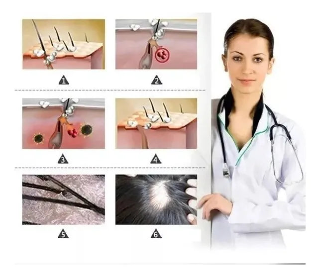 King of Ginger 7 Days – Suero Natural Anticaída y Crecimiento Capilar